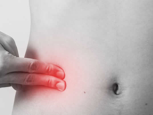 Cirugía de Apéndice