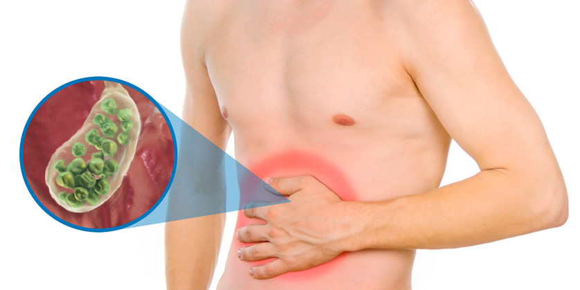 Cirugía de vesícula 